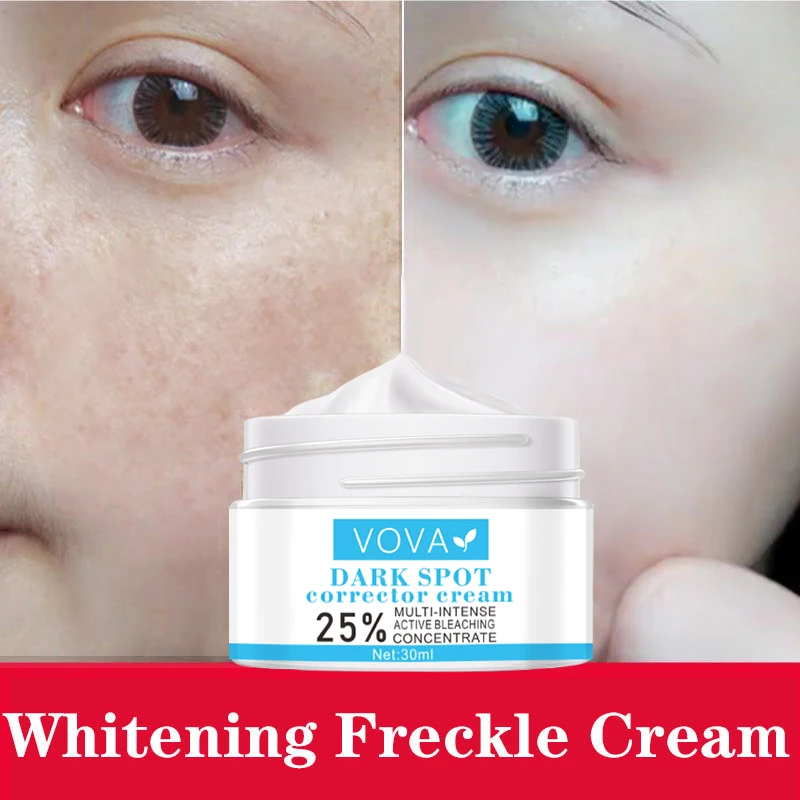 

Effective Whitening Freckle Cream Remove Melasma Acne Spot Pigment Melanin Dark Spots Pigmentation Moisturizing Gel TSLM1