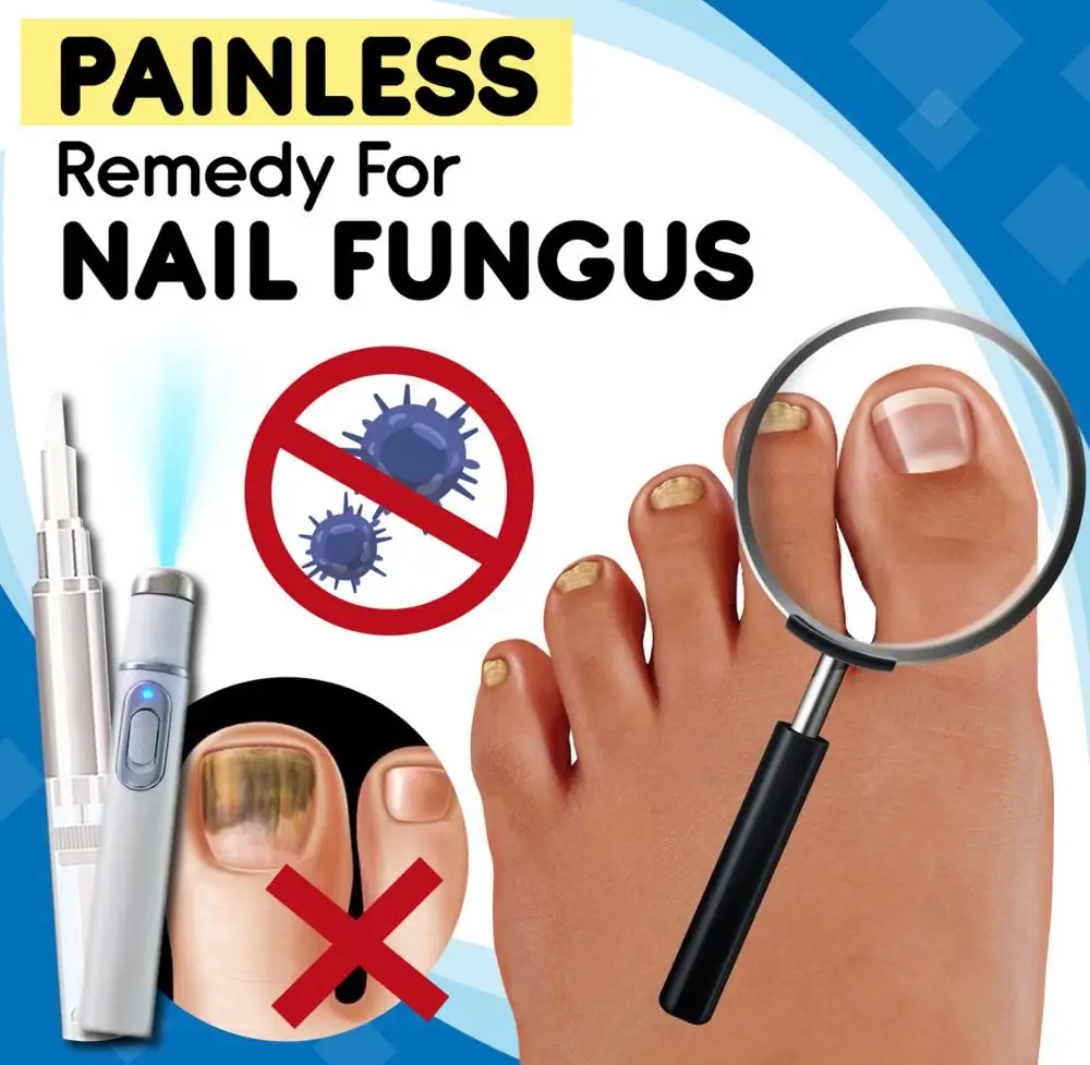 Anti-fungal Home Treatment Set Toe Nail Pen Onychomycosis Paronychia Anti Fungal Fungus Care Repair Serum Kit | Красота и здоровье