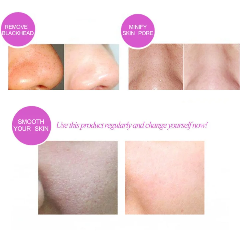 

Beauty Star Ultrasonic Face Cleaning Skin Scrubber Facial Cleaner Skin Peeling Blackhead Removal Pore Cleaner Face Scrubber