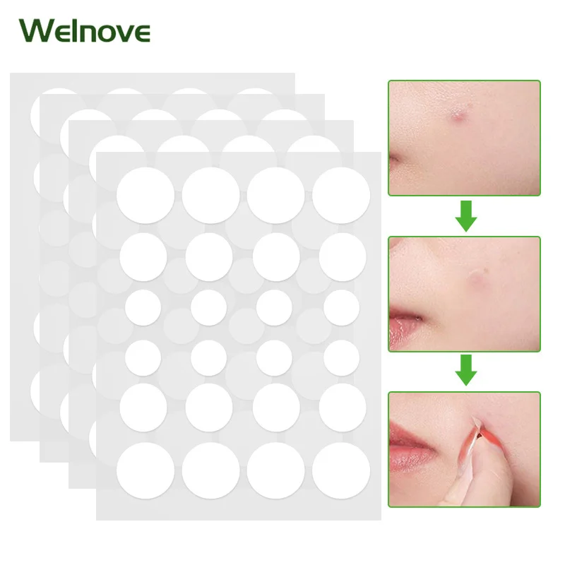 

24/48 шт акне прыщи патч наклейки, для лечения прыщей, инструмент для удаления прыщей инструмент для удаления пятна на лице, Смягчающая маска д...