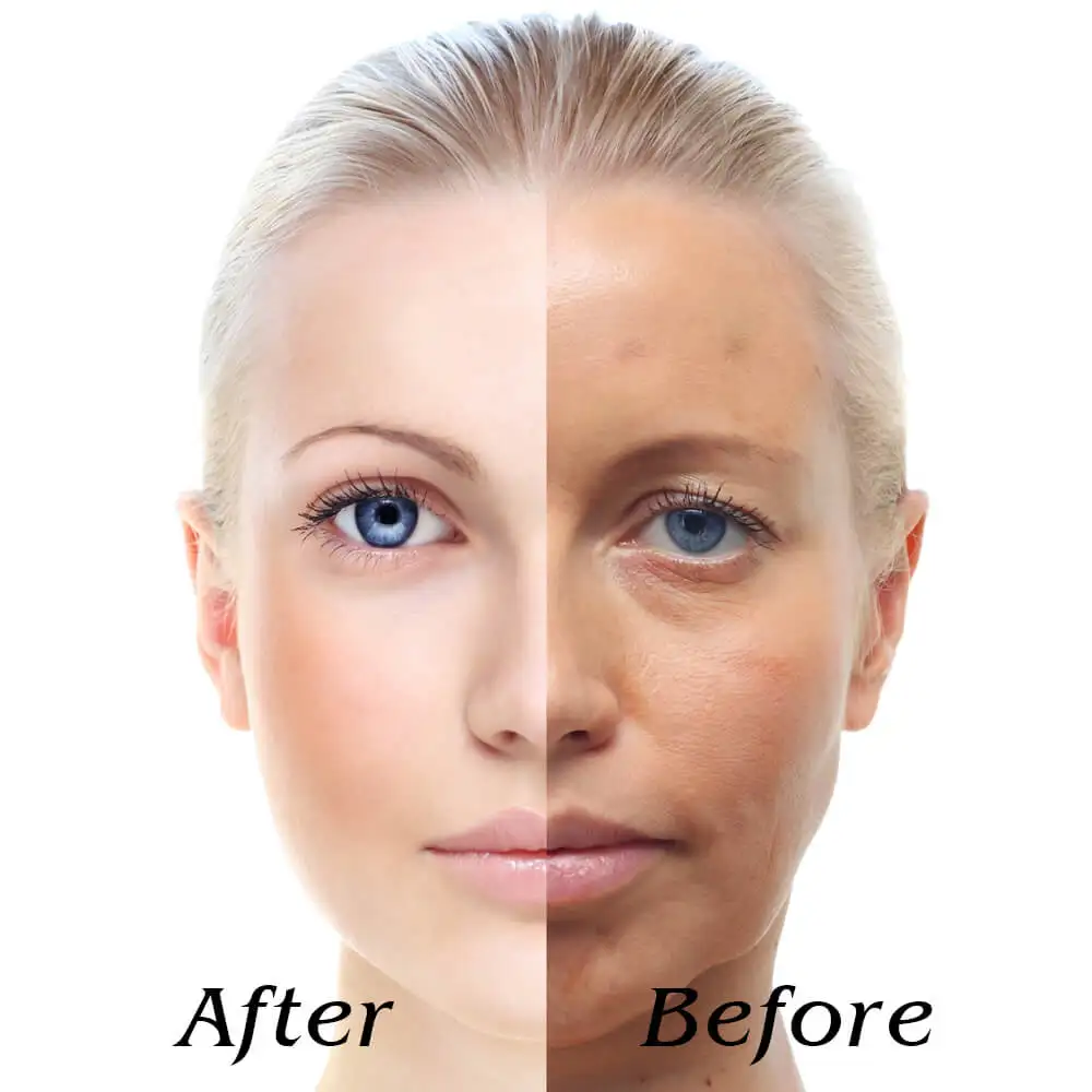 Фотонная лампа для лечения светодиодный светильник красоты лифтинга кожи