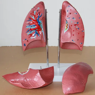 1:1 Lung anatomical model human Respiratory system Bronchial Model Medical Teaching free shipping