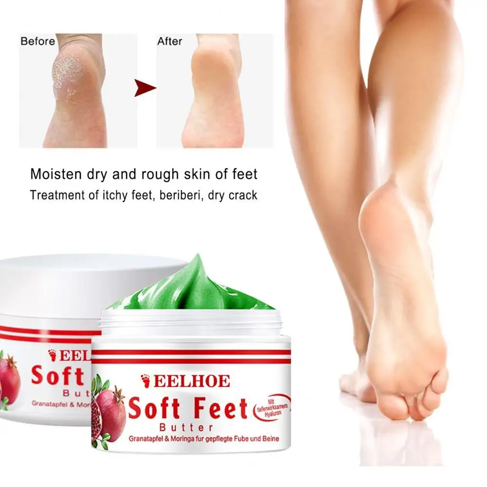 

15g/30g/50g Natural Dry Skin Cream Quick Absorb Deep Penetration Soft Feet Hands Skin Crack Treatment Cream for Adult