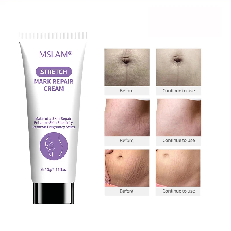 

Крем для удаления шрамов и растяжек, 50 г