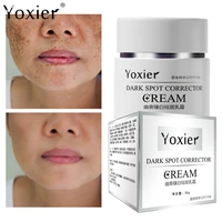 freckle cream remove facial spots moisturizing and whitening even skin tone anti aging deep nourishment repair facial care 30g