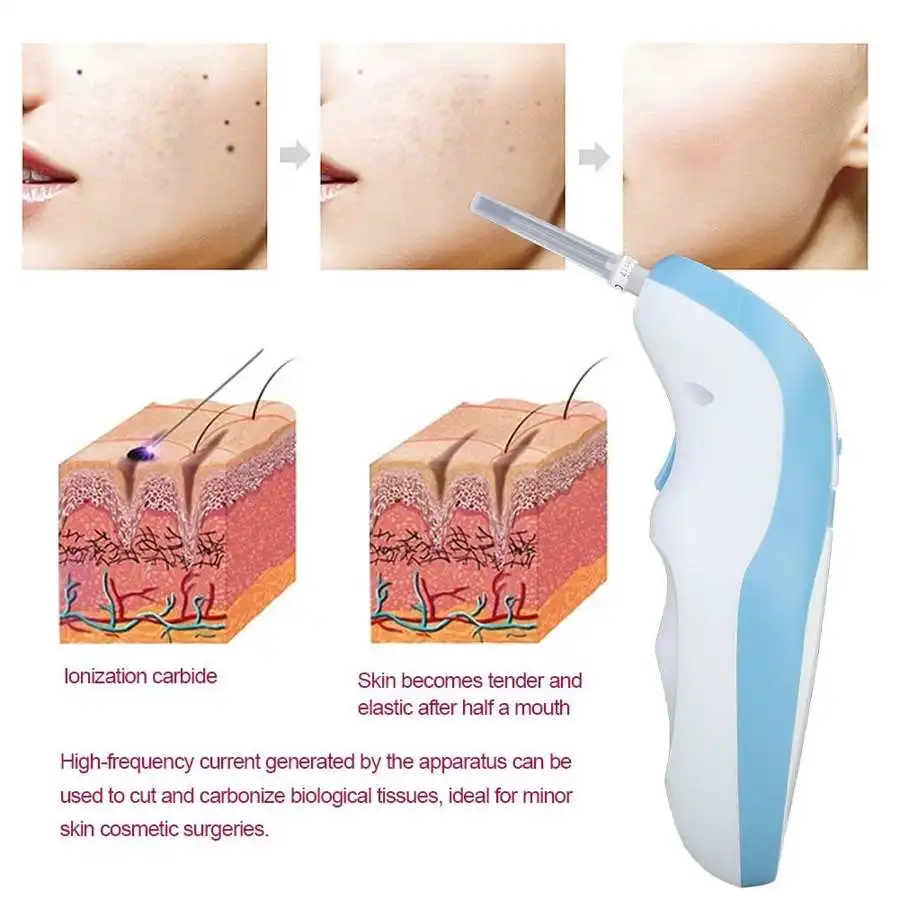 Лазерная плазменная ручка Fibroblast профессиональная машинка для ухода за кожей