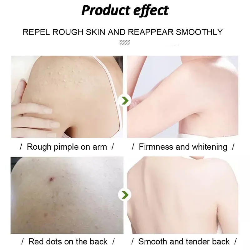 Отшелушивающий отбеливающий для тела 350 мл | Красота и здоровье