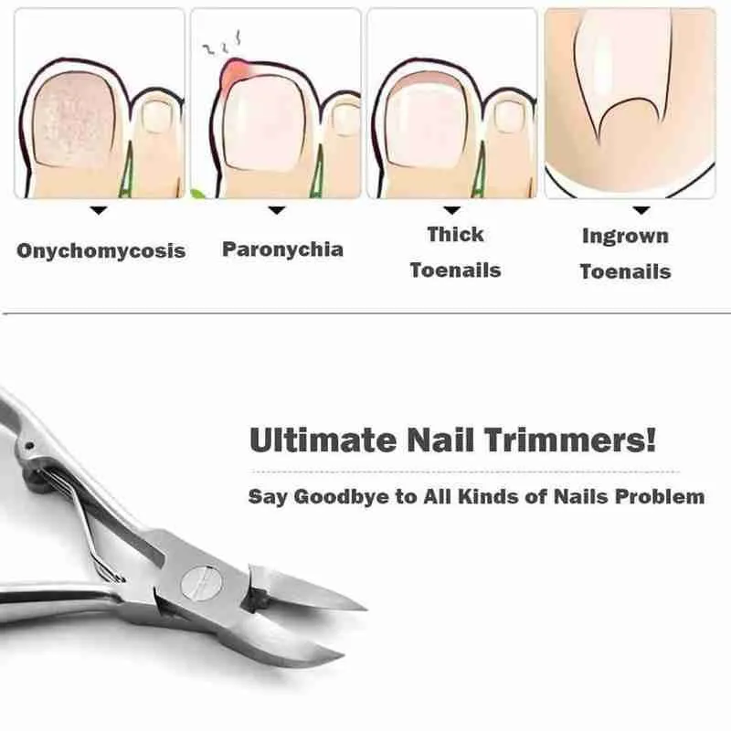 

Pro Nail Scissors Special Nail Scissors Oblique Mouth Groove Nipper Olecranon Skin Nail Dead Tool Toenails Trimmer G2F1