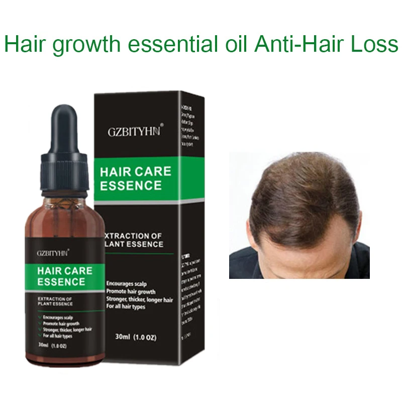 30ml New Hair Growth Essence Oil  Fast Powerful Hair Growth Oil  Products Essential Oil Treatment Preventing Hair Loss Hair Care