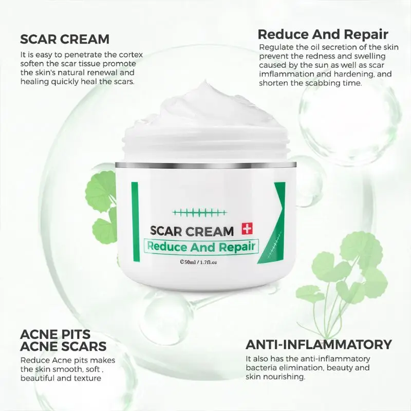 

50ml Scar Removal Cream Acne Stain Treatment Stretch Marks Surgery Burning Pigmentation Fading Spot Repair Balm Skin Care