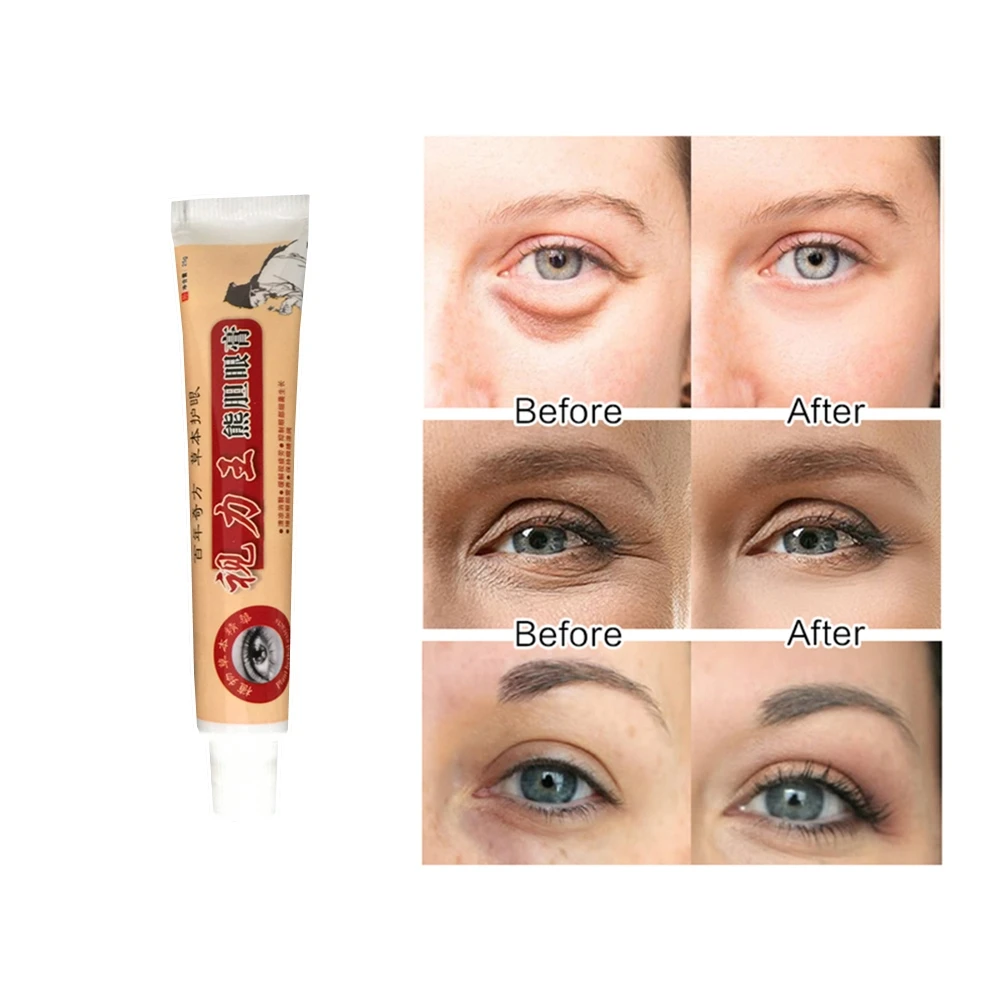 1 шт. увлажняющие патчи для области вокруг глаз от Тёмных кругов и мешков под