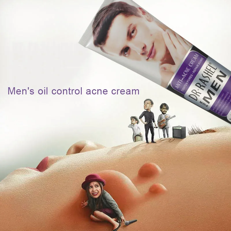 

Anti Acne Cream for Men Oil Control Scar Removal Moisturizing Cream Skin Care M88