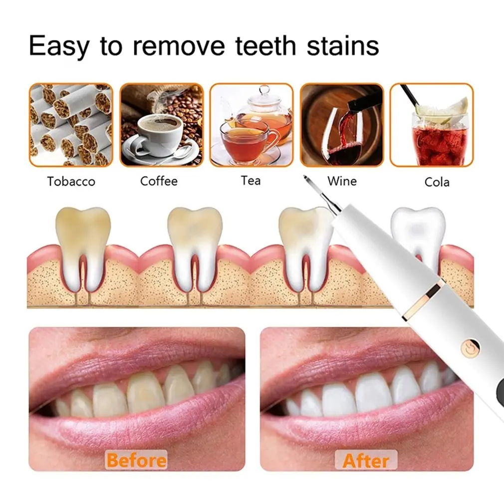 

Electric Sonic Tartar Scaler Oral Teeth Tartar Remover Plaque Stains Cleaner Removal Teeth Portable With LED