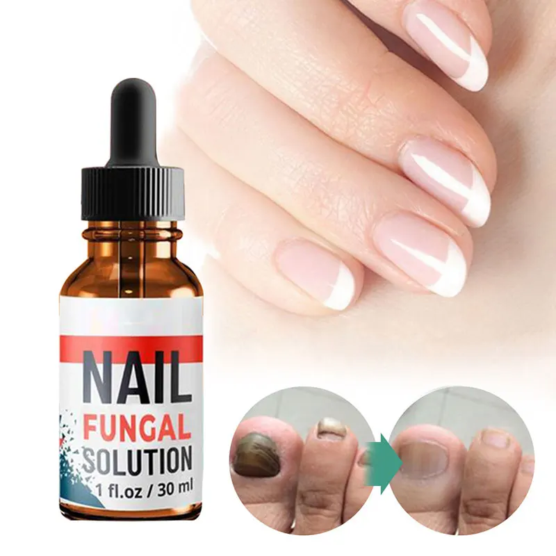 

Nail Repair Solutions Brighten Repair Nourish Toenail Fingernail Nail Care Liquid J9