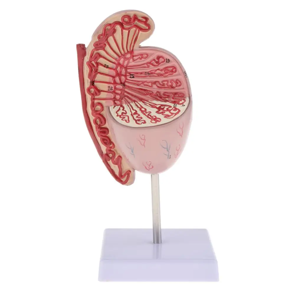 

Life Size Human Kidney Diseased Model Anatomical Anatomy Diseased Pathological Stone Organ Teaching Supplies