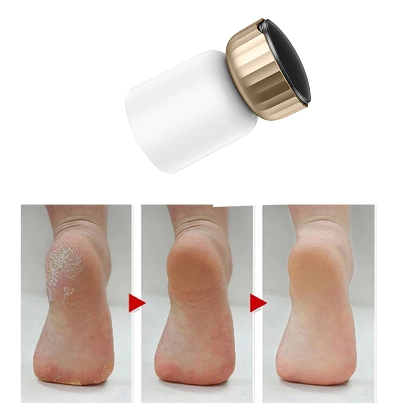 Горячая Распродажа Электрический Отшелушивающий аппарат для удаления мозолей