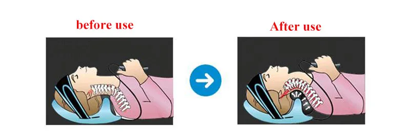 Надувной аппарат для лечения шейного отдела позвоночника | Красота и здоровье