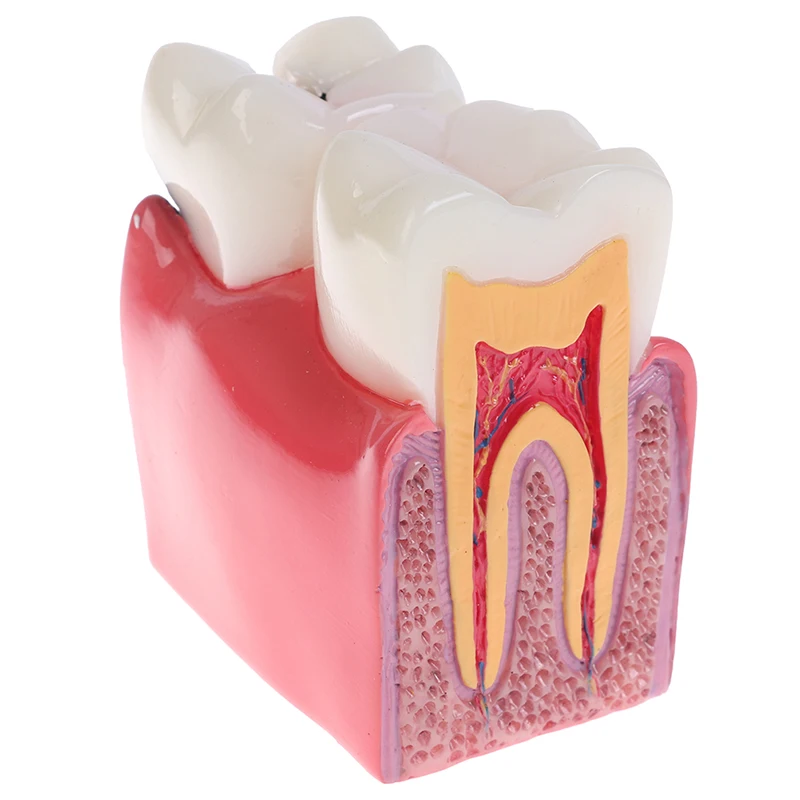 

Стоматологическая модель зубов 6 моделей зубных протезов