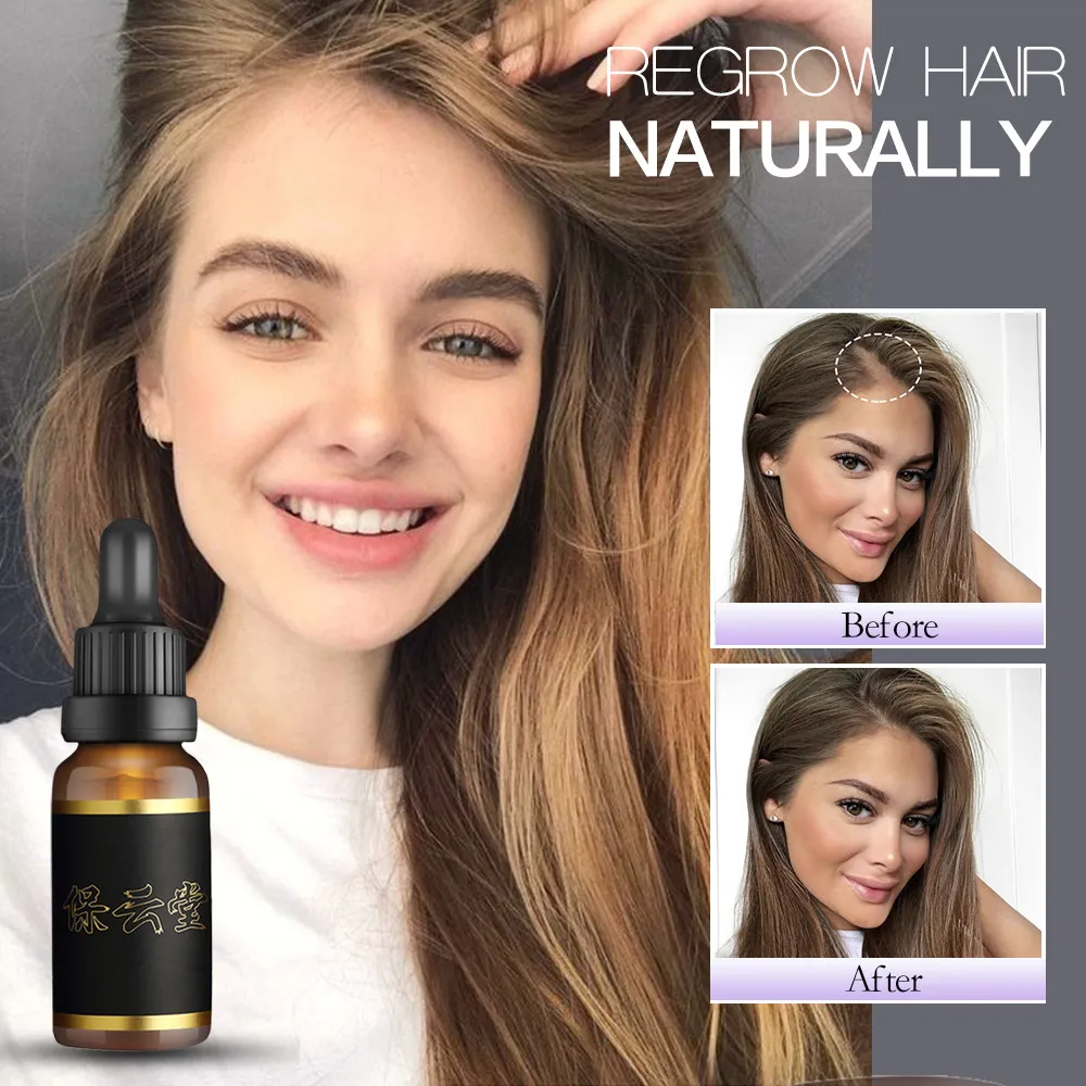 

Hair Care Hair Growth Essential Oils Essence Hair Loss Liquid Health Care Beauty Dense Hair Growth Serum Fast Grow Hair 30ml