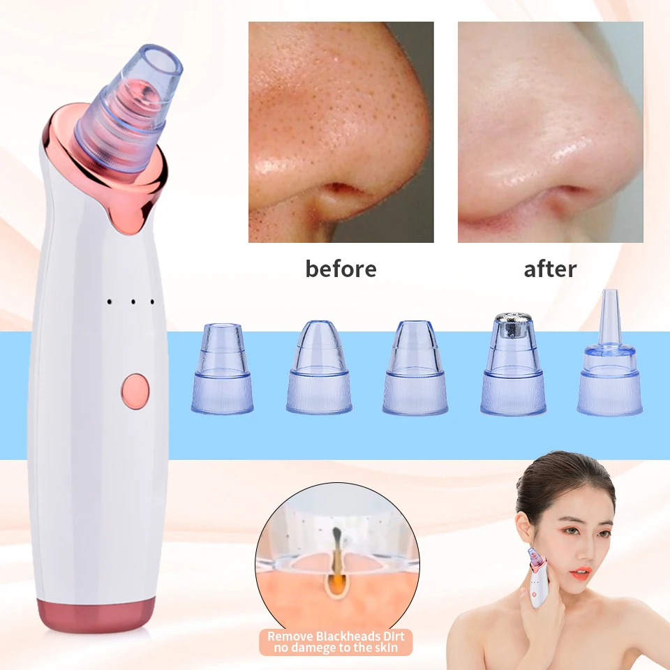 Электрический прибор для удаления черных точек инструменты ухода за кожей лица