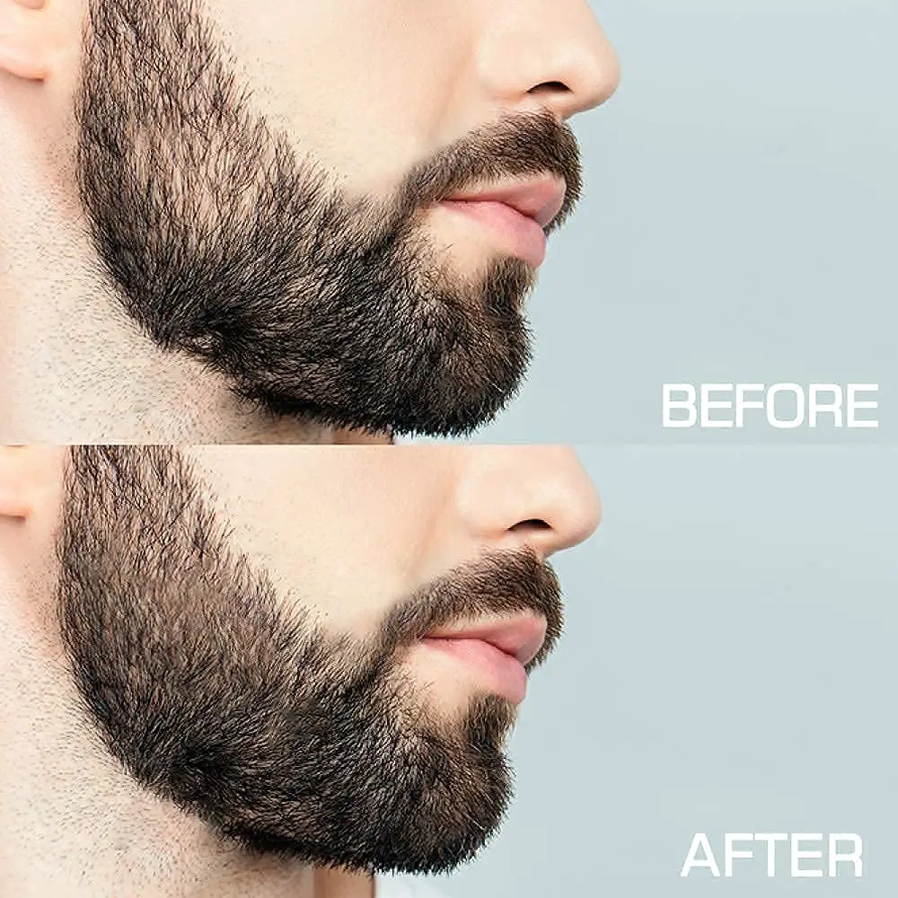 Микро игла 540 ролик Дерма Дермароллер Титановый рост волоса Борода Рост препараты против выпадения Обработка тонировки.