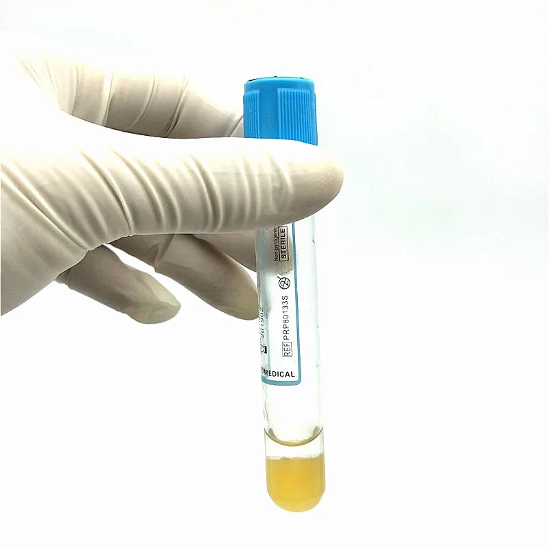 Стерильный вакуумный тюбик для забора крови 8 мл контейнер с цитратом натрия и