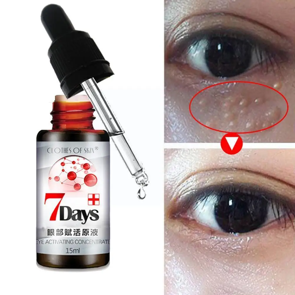 

Eye Rejuvenating Essence To Reduce Dark Circles And Bags Eye The Eyes Shrink To Particles Remove Pores Under Cream Fat