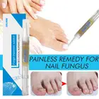 Eelhoe 3 мл ручка для восстановления ногтей, лечение онихомикоза, паронихия, противогрибковые ногти, китайский травяной дизайн ногтей TSLM2