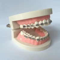 dental orthodontic teeth model with metal bracket braces school teaching equipment demonstration orthodontic tooth model