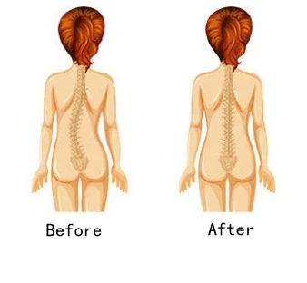 Пояс-корсет Женский на молнии со стальными косточками | Женская одежда