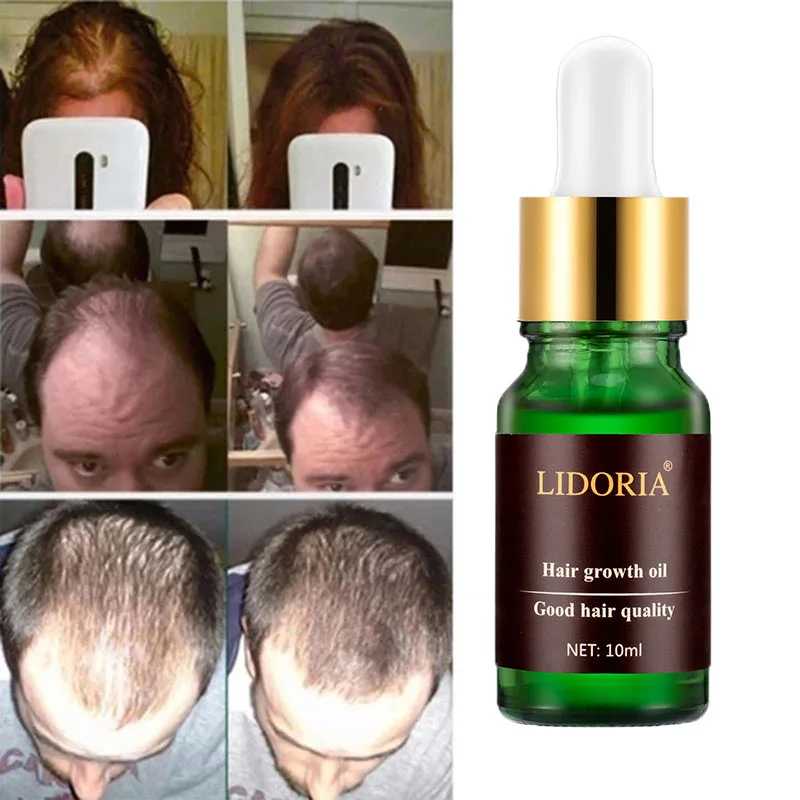 

Hair Growth Serum Natural Treatment Hair Care Growing Thicker Serum Ginger Oil Serum Treatment Loss Preventing Alopecia Fast