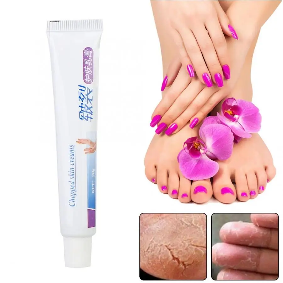 Крем для лечения сухого трещины рук на пятке шелушение Исцеление крем 20 г массаж