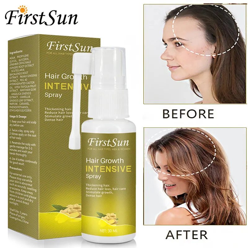 Ginger Hair Growth Spray Anti Hair Loss Nourish Roots Thick Shiny Fast Growing Oil Health Care Beauty Dense Hair Regrowth Serum