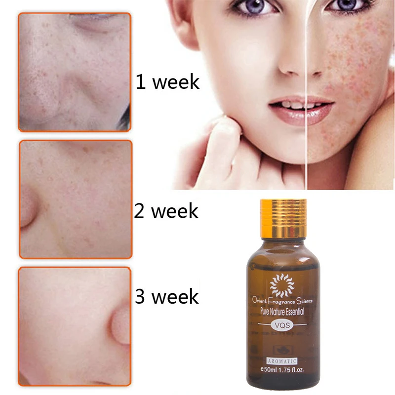 Natural Essential Ultra Brightening Spotless Oil Skin Care Dark Spots Remove Acne Burn Scar Removal Whitening Essence |