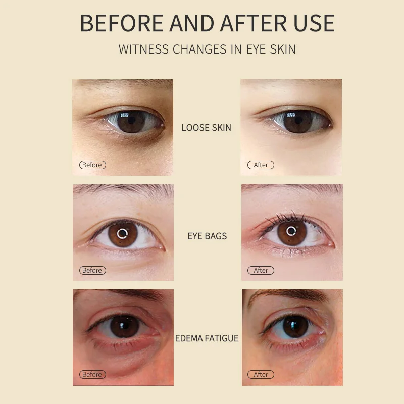 

"MSLAM Sea Caviar Eye Mask Black Gold Eye Patch Collagen Anti-Aging Anti-Puffiness Unisex Moisturizing Eye Bags Removal "