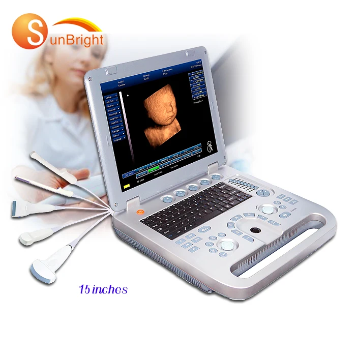 

Hot Selling laptop ultrasonic price ultrasound