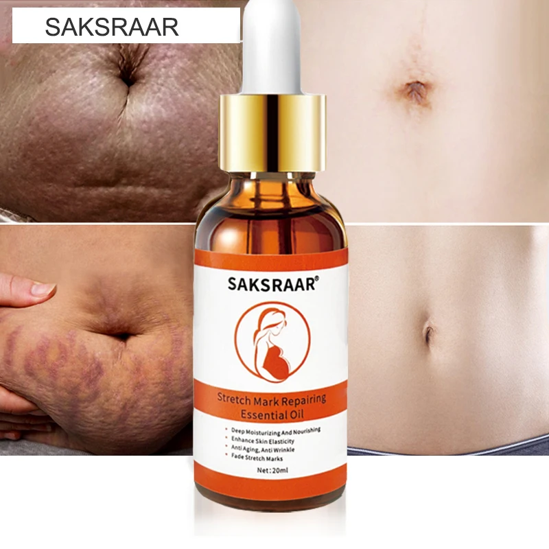 Stretch Marks Remover Essential Oil Skin Care Treatment Cream For Mark Removal Maternity Slackline Pregnant Oils | Красота и здоровье