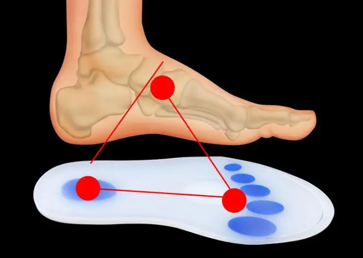 1 Pair Orthotic Arch Support Massaging Silicone Anti-Slip Gel Soft Sport Shoe Insole Pad For Man Women insoles Shock Absorption