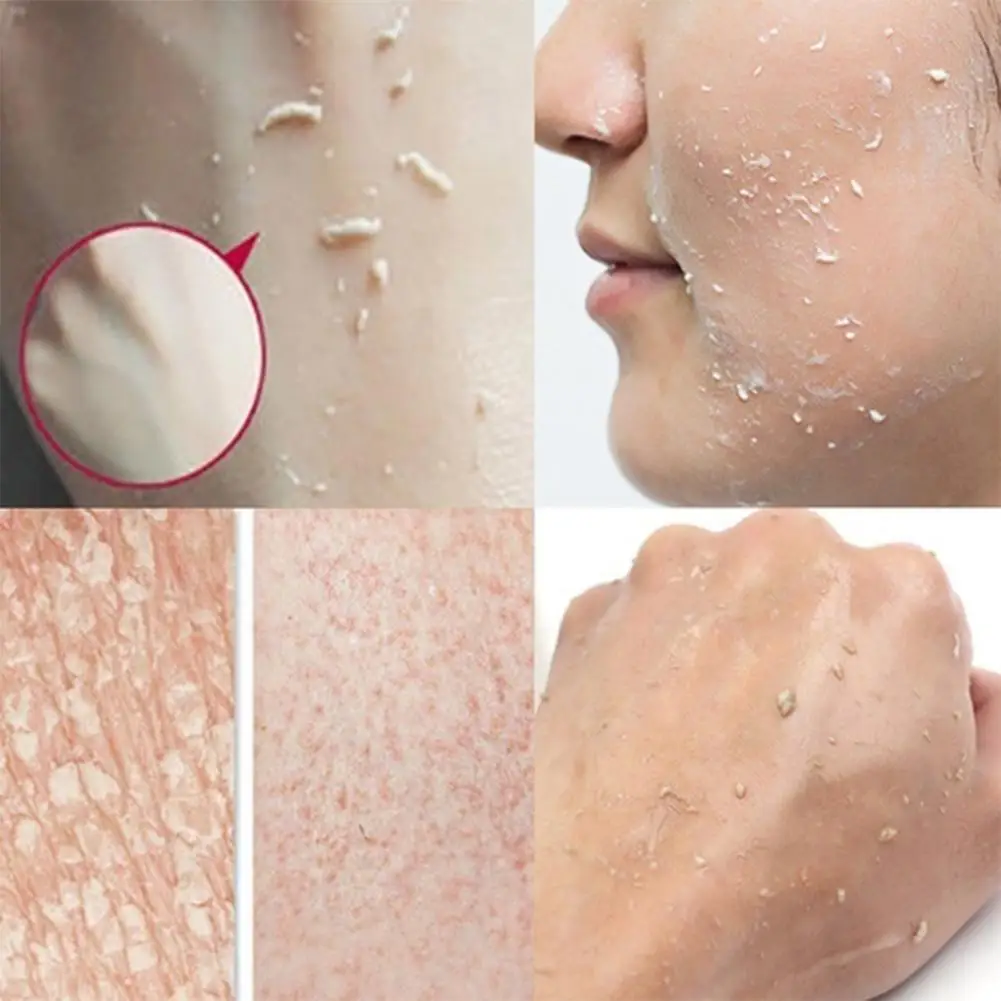 Отшелушивающий скраб для лица пилинг гель увлажняющий отбеливающий витамин C и