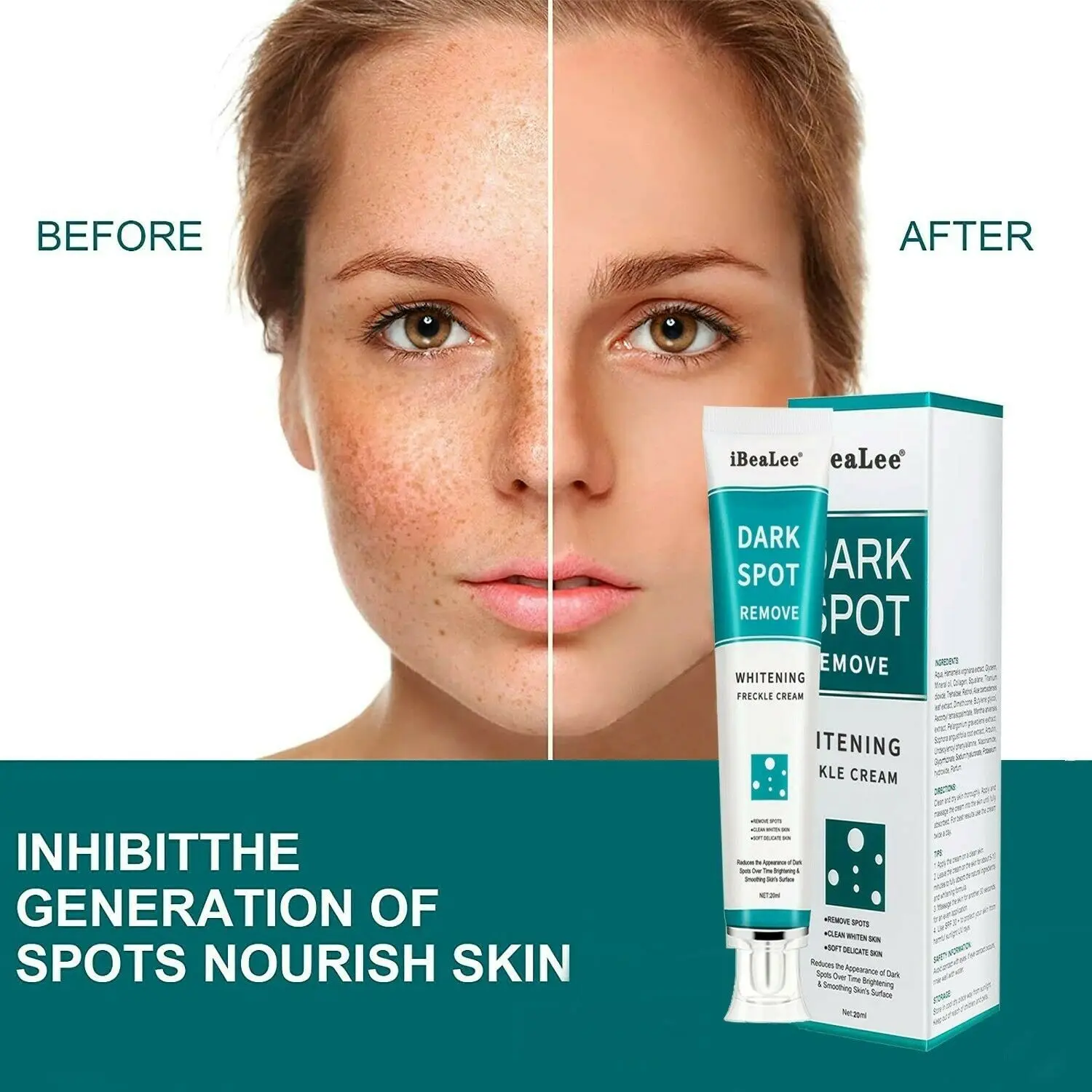 

Hot Face Care Skin Care Dark Spots Whitening Freckle Cream Remove Melasma Melanin Removal Acne Spot Pigment