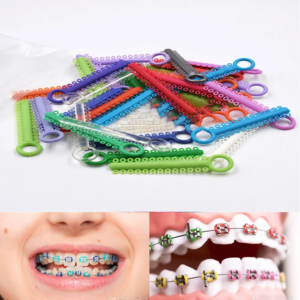 40 шт. Стоматологические Ортодонтические лигатурные галстуки эластичные