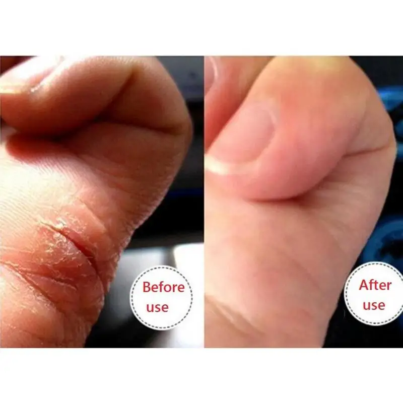 25g Repairing Moisturizer Foot Cream Anti-chapping Skin For Rough Dry Cracked Chapped Feet Heel Hand Cleft Healing Oil |