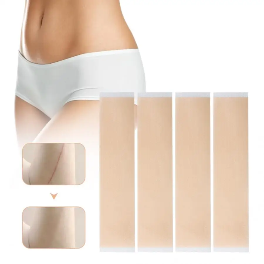 Самоклеящаяся Силиконовая накладка ALIVER для смягчения кутикулы лечения кесарева