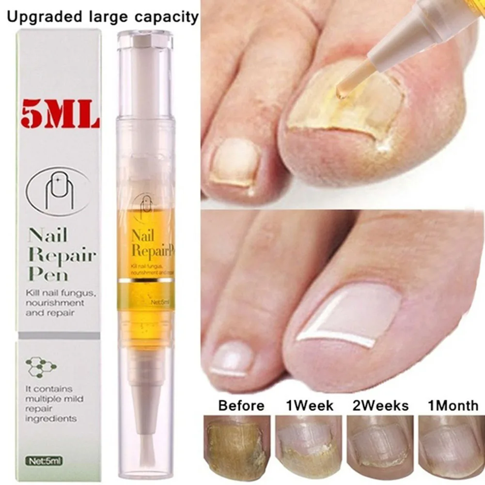 5 мл ручка для обработки ногтей жидкая кутикула восстанавливающее масло