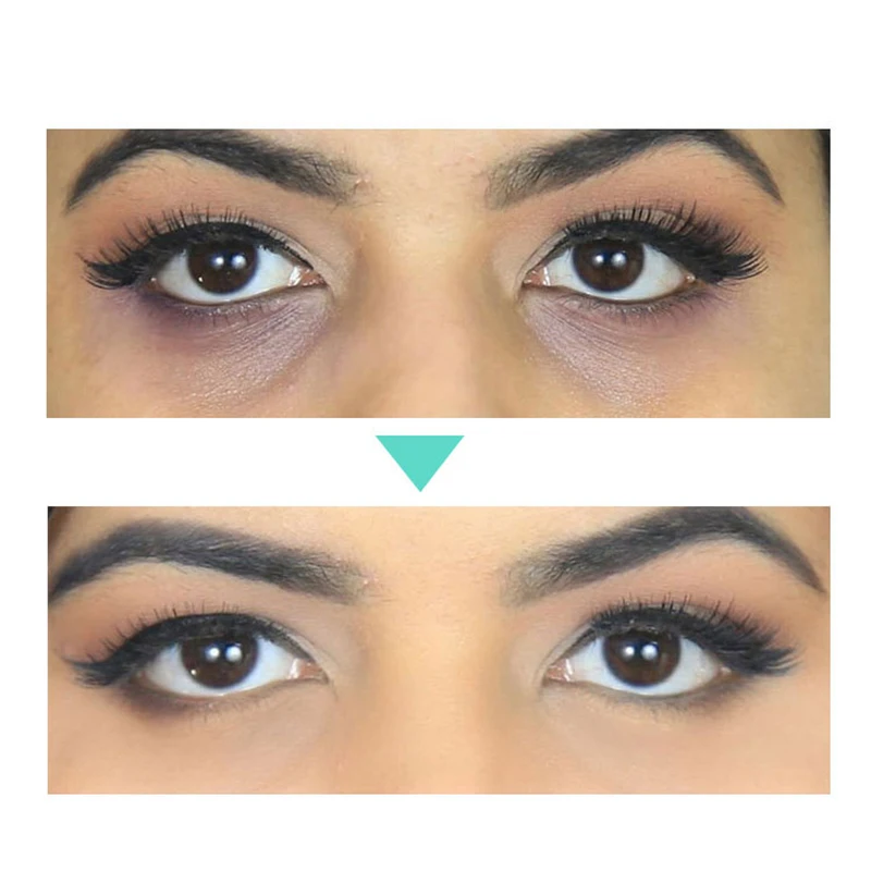 

Ретинол уход за кожей лица крем для ухода за областью вокруг глаз подъема антивозрастной от мешков под глазами, удаление морщин