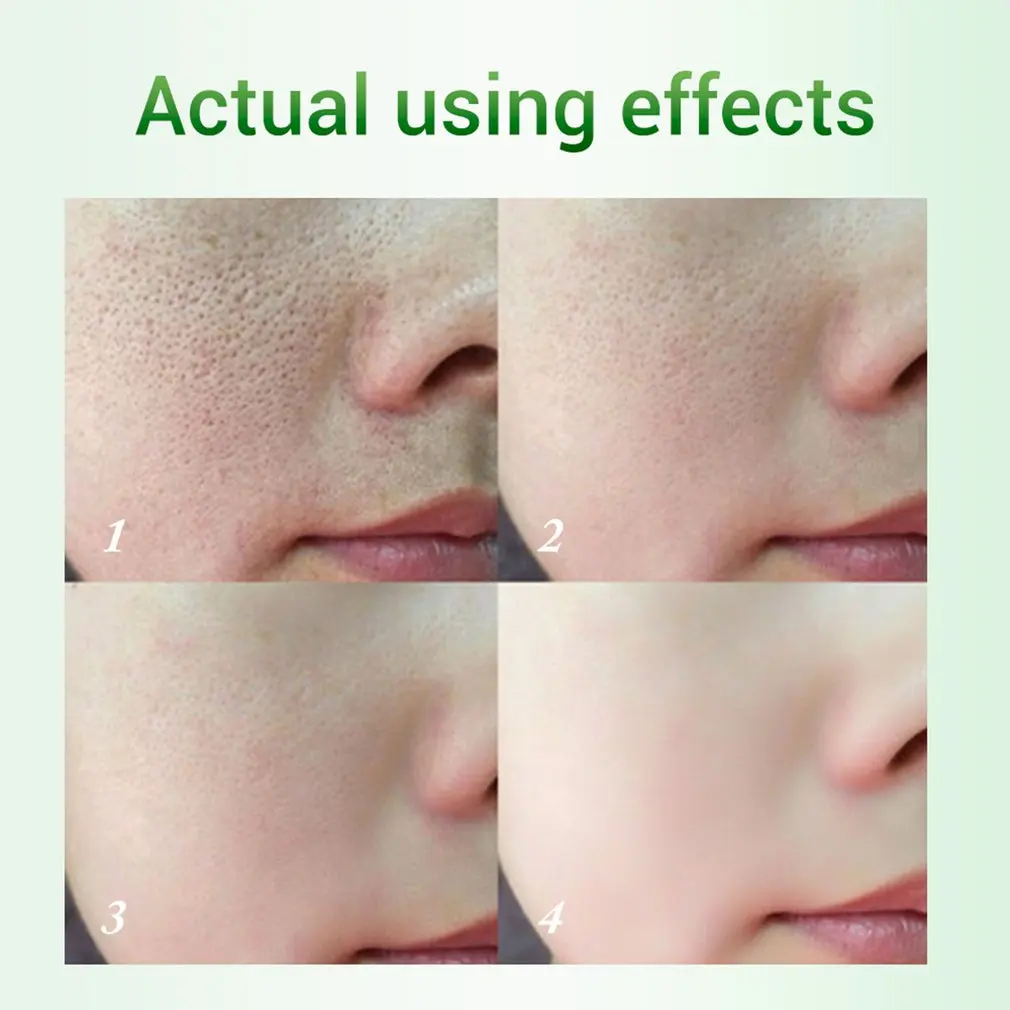 

Refining Serum Face Mask Serum Narrowing Pores Skin Moisturizer Firm Brightening T Zone Skin Care Essence 17ml