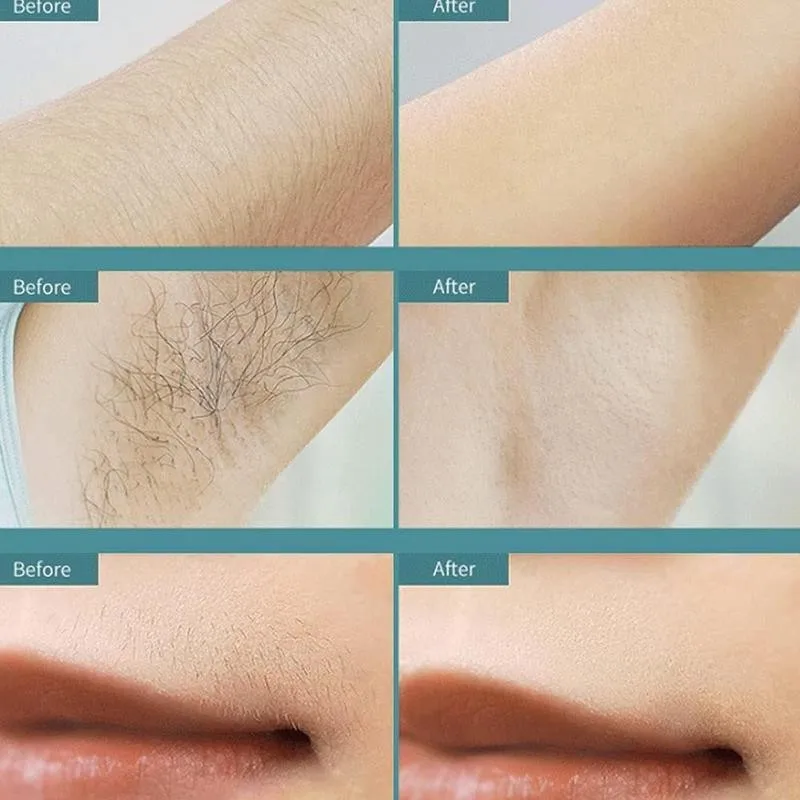 

Home Hold Depilatory Mini Hair Epilator Permanent Hair Whole Pulses Light Shot 500000 Removal Body System Hair Remover IPL Y4S5