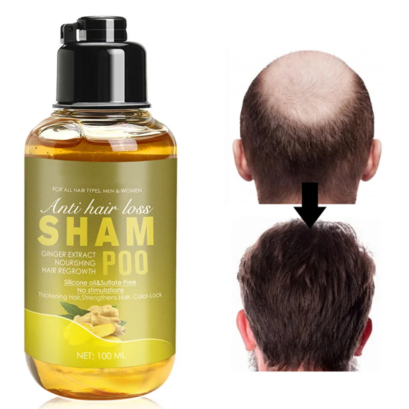 

100ml Anti-stripping Ginger Extract Shampoo Anti-Loss Oil Control Bath Accessories Unisex STTX889