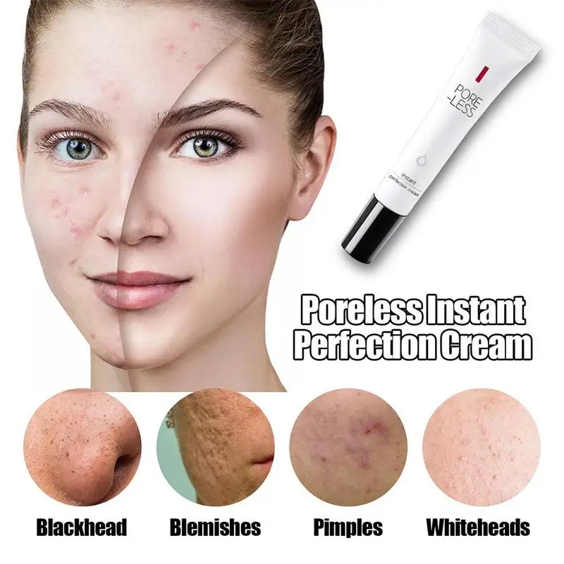 20g Acne Cream Delicate Repair Acne Scar Mark Shrink Pores Moisturizing Oil Control Beauty Face Purifying Remove Acne Cream