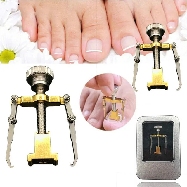 Ingrown Toenails Pedicure Foot Nail Care Tools File for Feet Orthotic Acronyx Ingrowing Onyxis Bunion Corrector Massage |